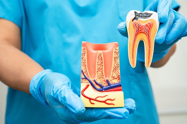 Signs Of A Failed Root Canal
